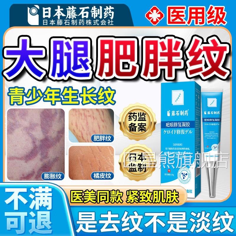 去大腿内侧肥胖纹修霜生长纹消除大腿学生去肥胖纹复男女修复膏OM