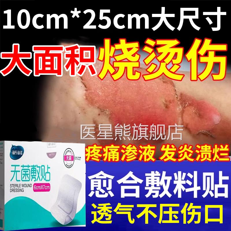 烫伤保护贴大面积烫伤专用纱布湿性愈合敷料透气伤手脚烧伤灼贴医