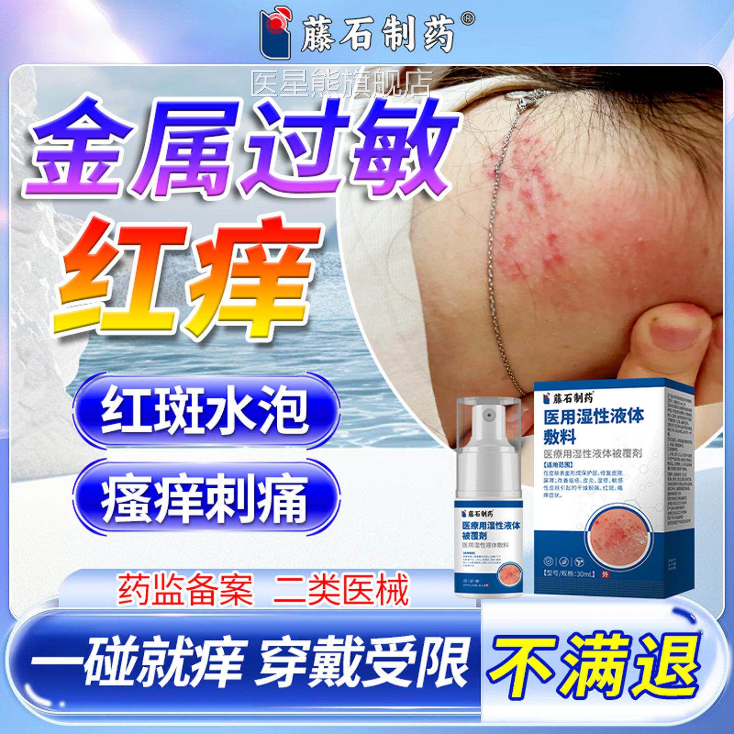 防皮肤金皮属过敏止痒喷剂膏手表耳环带金属扣红疹皮炎药房同售YI