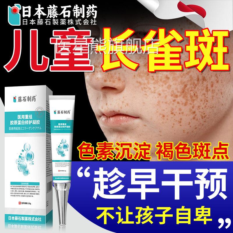 儿童上点雀斑专用祛黄褐斑除霜晒斑去医用型除修复脸膏药房同售OM