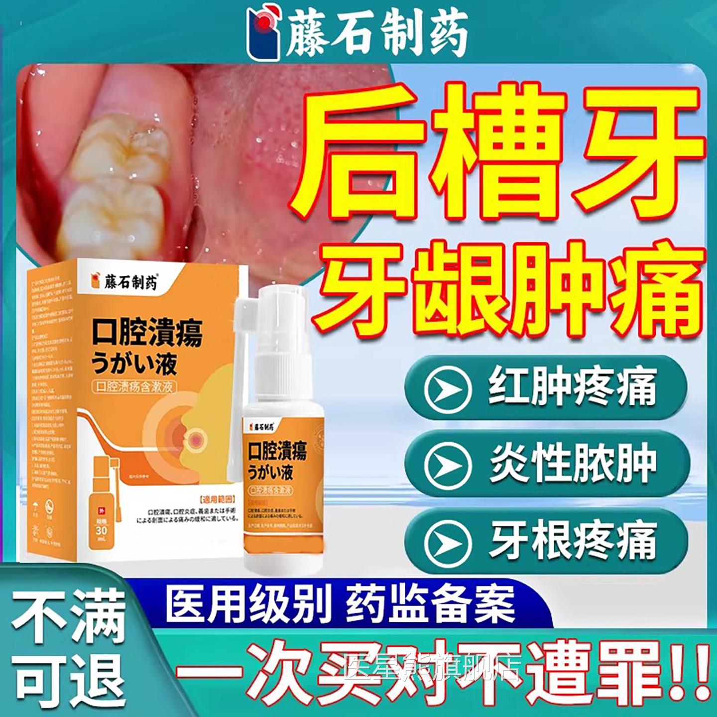 后槽牙龈肿止痛消口腔牙周炎喷雾智齿冠周上火炎神器牙根脓包剂SK
