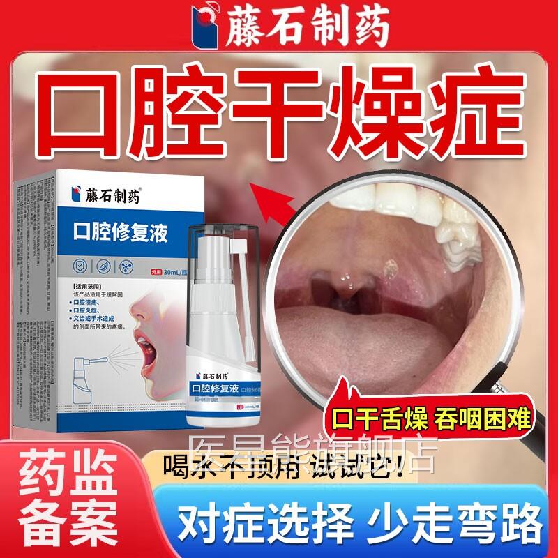 女性灼口干燥综合征口苦舌燥药房同售可搭人工唾液凝胶喷雾剂症SK