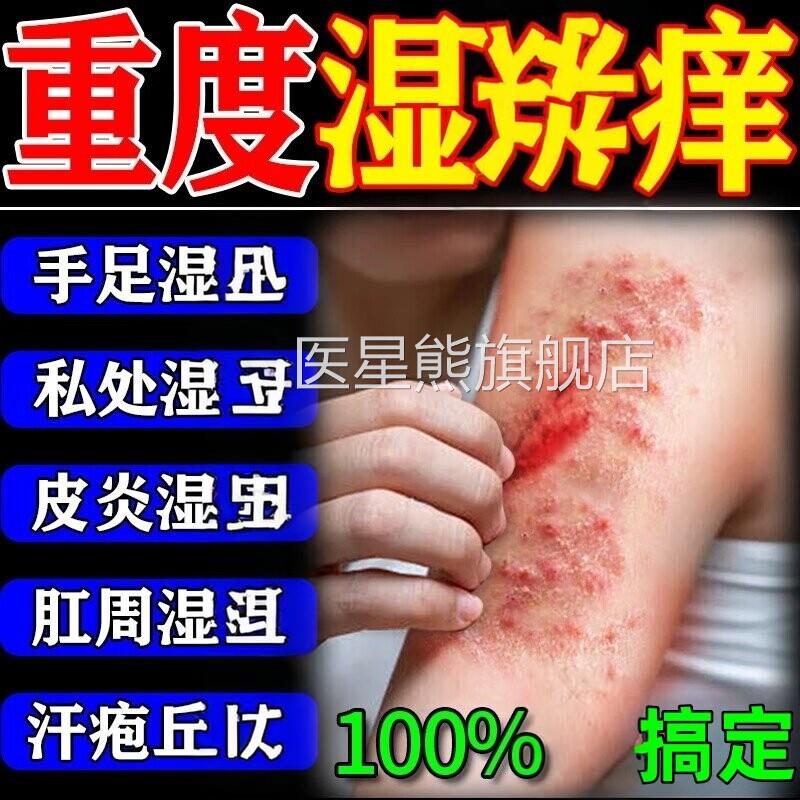 云真南菌王百草膏苗医药痒止特皮瘙肤痒疹湿拔毒断痒正品菌抑膏医