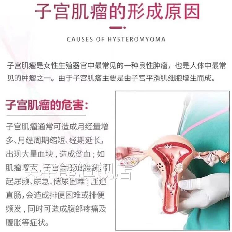 子肌瘤泡脚包中药贴卵巢囊肿消茶宫瘤清自己治热敷女宫性调理疗LL