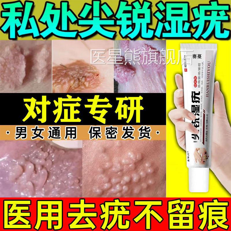 男性女生殖器尖锐湿疣专用膏hpv去尤克星鬼臼毒素除神器软膏特GX
