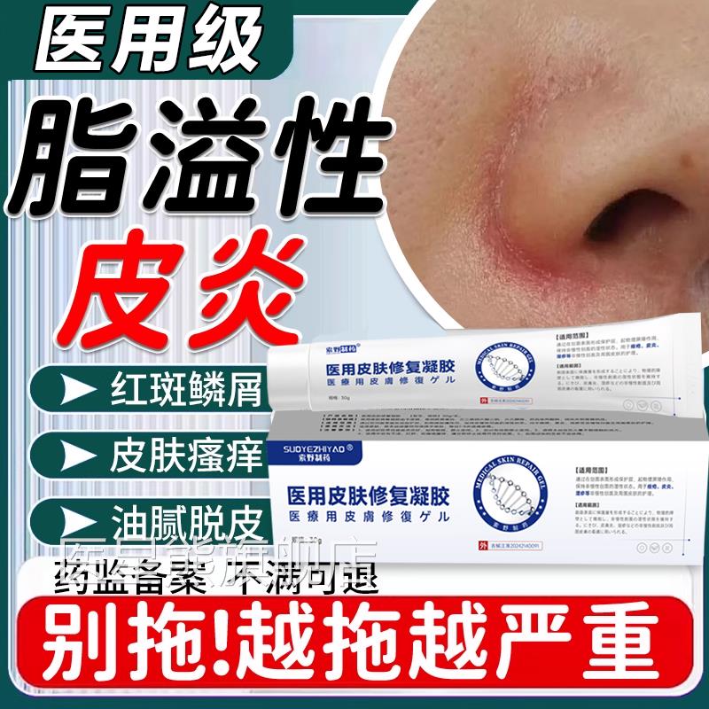 鼻翼子脂溢性皮炎鼻两侧泛红面部脸上皮肤干燥起皮脱皮软膏Y7医星