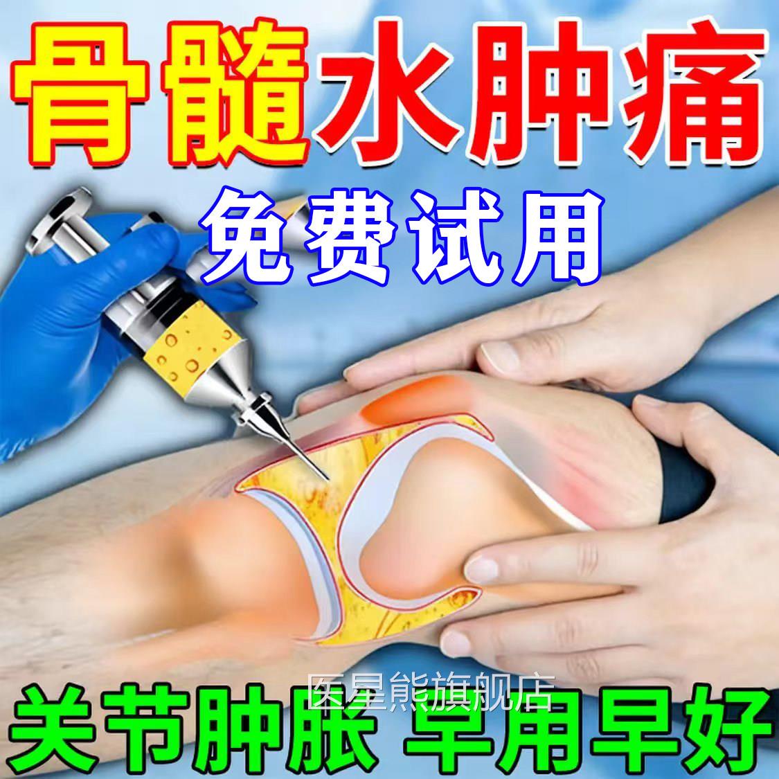 膝盖扭骨髓水肿热敷贴消肿化瘀脚腕疼痛崴脚韧带损伤积液专用膏药