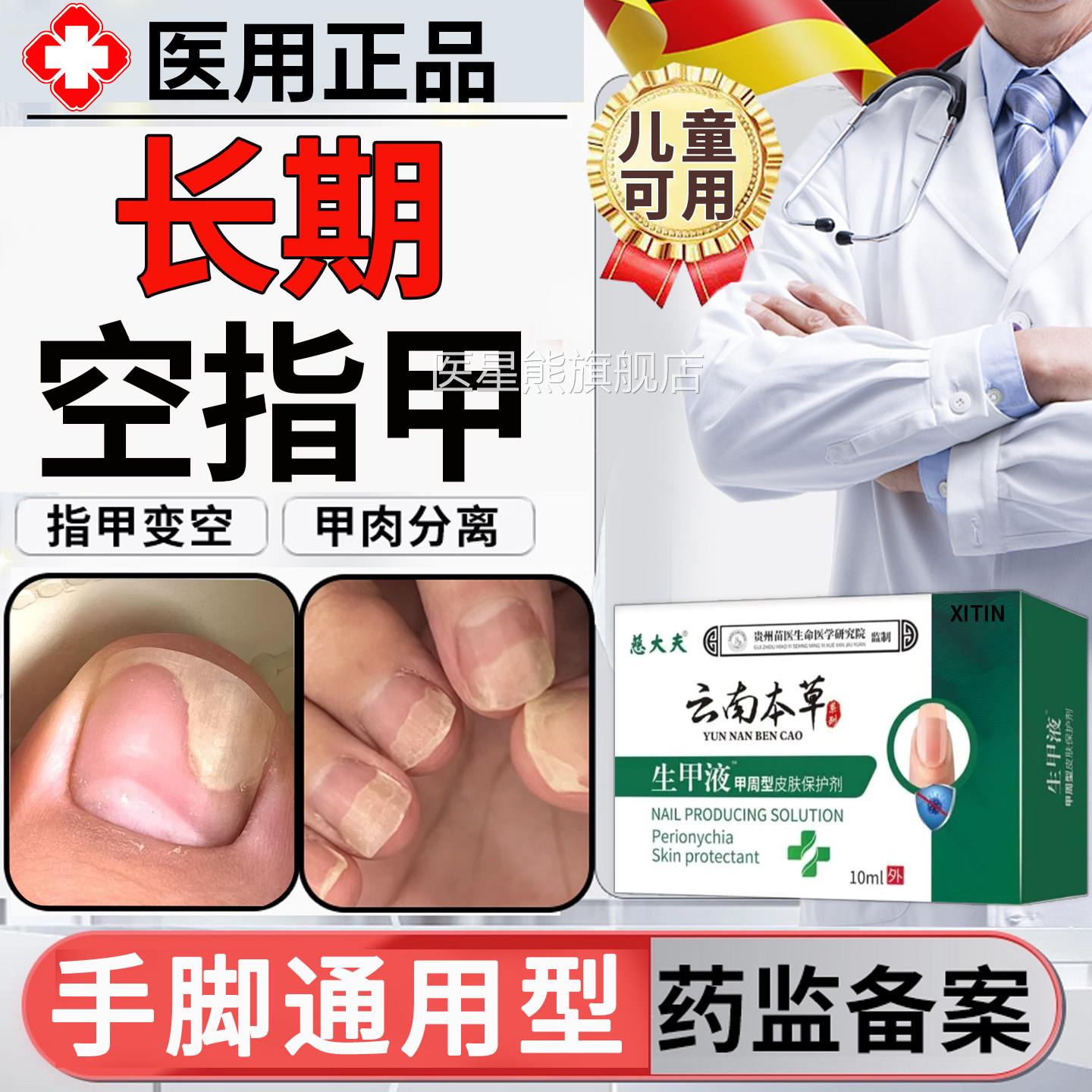 手脚空指甲甲分离空甲修复专用床儿童指甲真菌感染游离线生长液TT