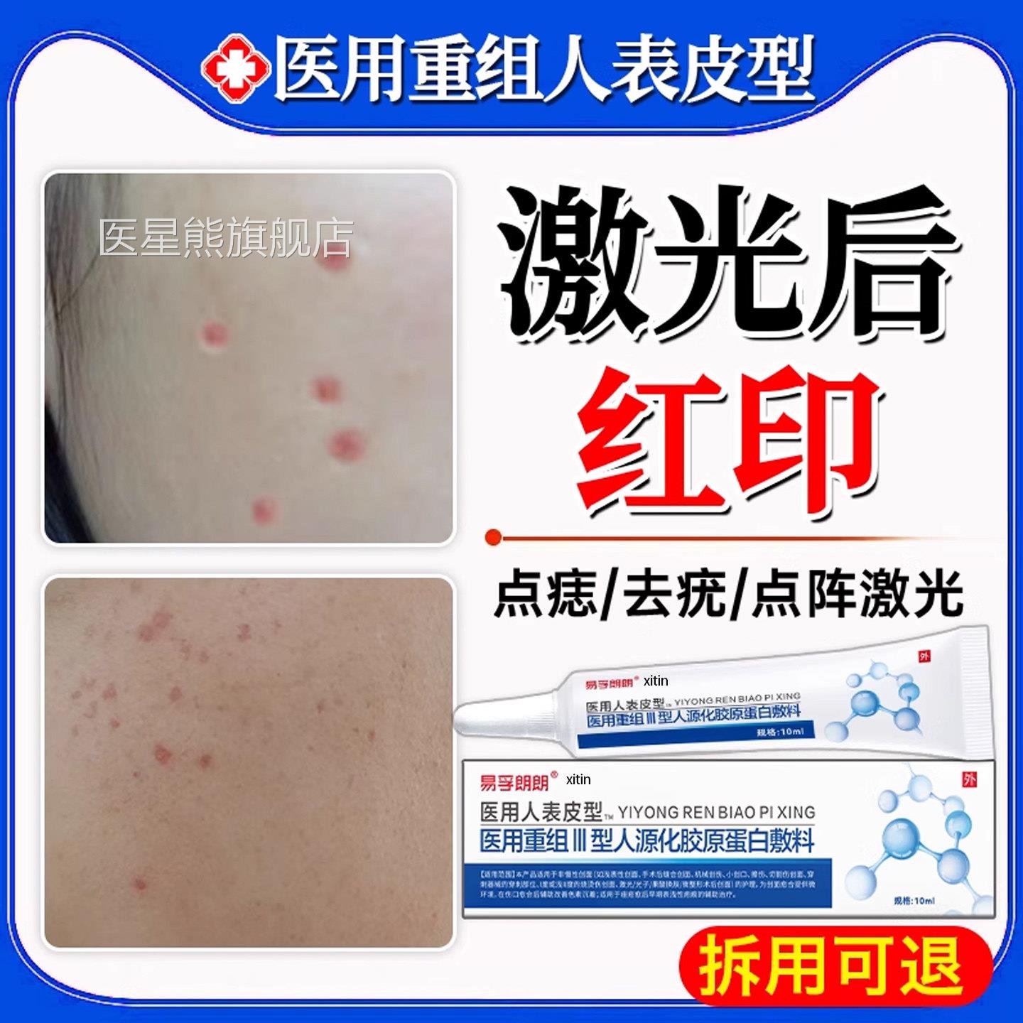痣激光祛斑术后点痣后修复膏产品去红印黑印退红淡印消印疤痕祛TT