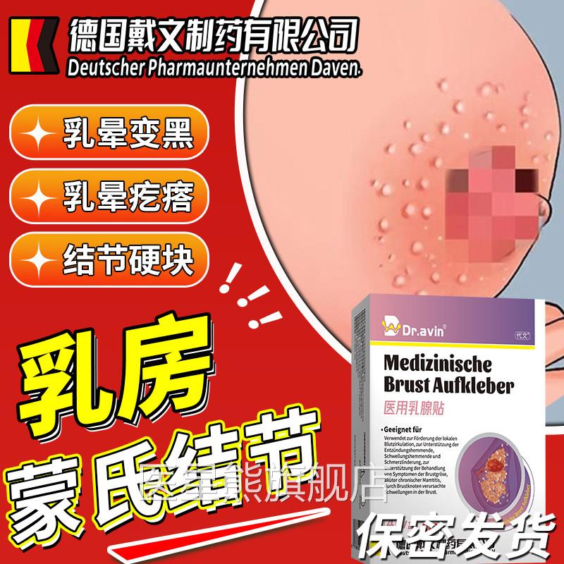 乳腺乳房蒙氏结节散结贴去疏通硬块囊小疙瘩除复乳肿腺增生乳晕OM