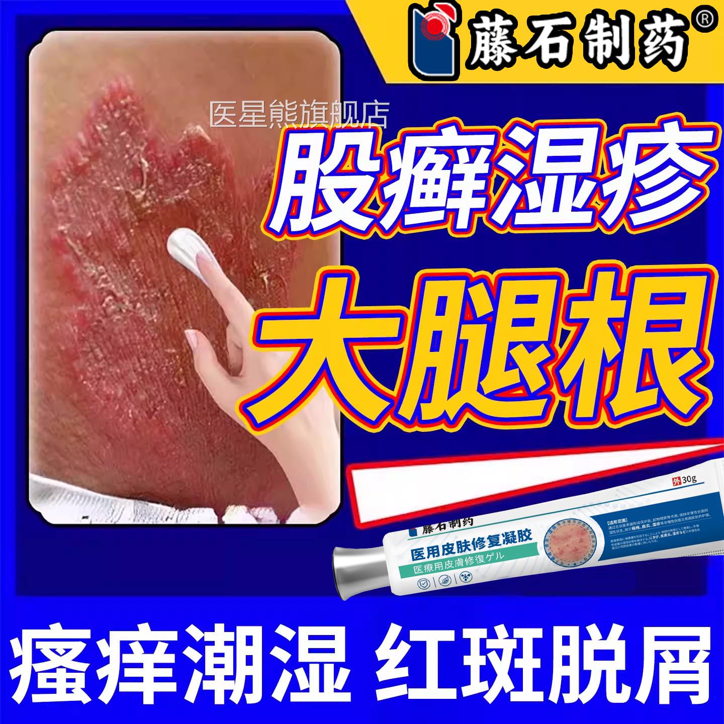大腿内侧皮肤瘙痒股藓股沟阴腹囊瘙痒湿疹止痒私处睾丸痒去男根CA