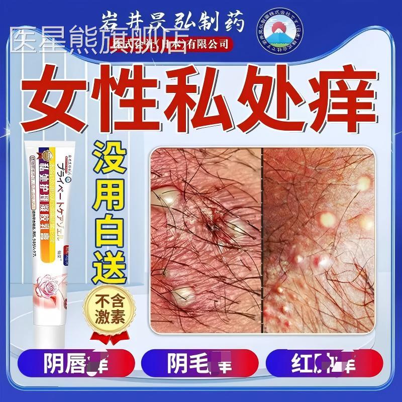 外阴瘙痒止痒膏女私处正品科专用妇止痒阴道去私处特效官方旗舰医