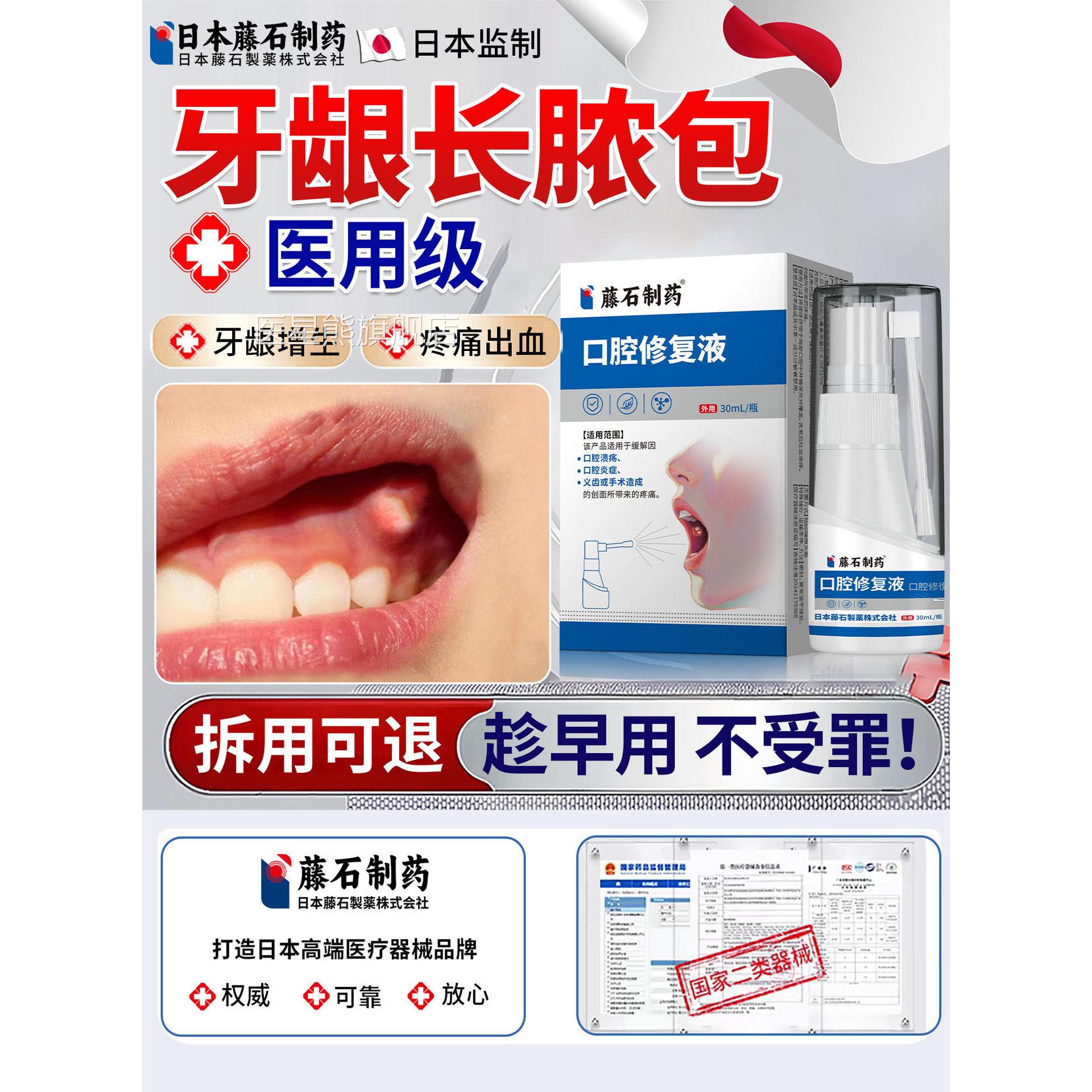 龈脓包肿痛消炎专用喷剂治牙根发炎牙周炎智齿牙冠鼓包药房同售OM
