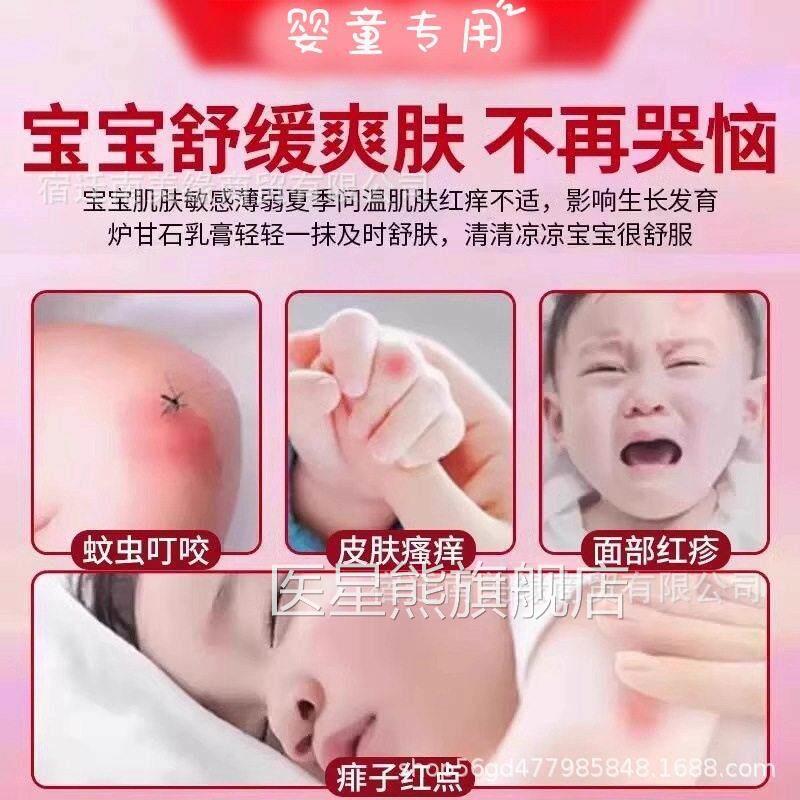 丝凯炉甘石宝宝倍缓护修膏0-GL用12岁丽婴幼儿外去痱子无刺激R消