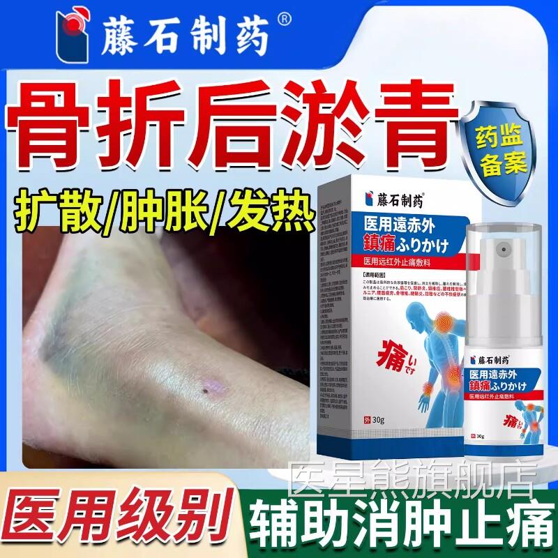 淤青膏骨折淤青磕碰摔伤跌打损伤消肿喷雾活血化瘀筋止痛喷雾舒SK