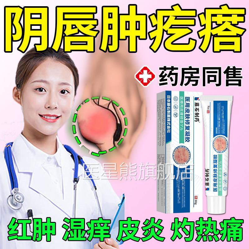 药瘩房同售外阴坠胀小阴唇长有硬疙红疼痛前庭大腺囊肿毛囊炎膏JA