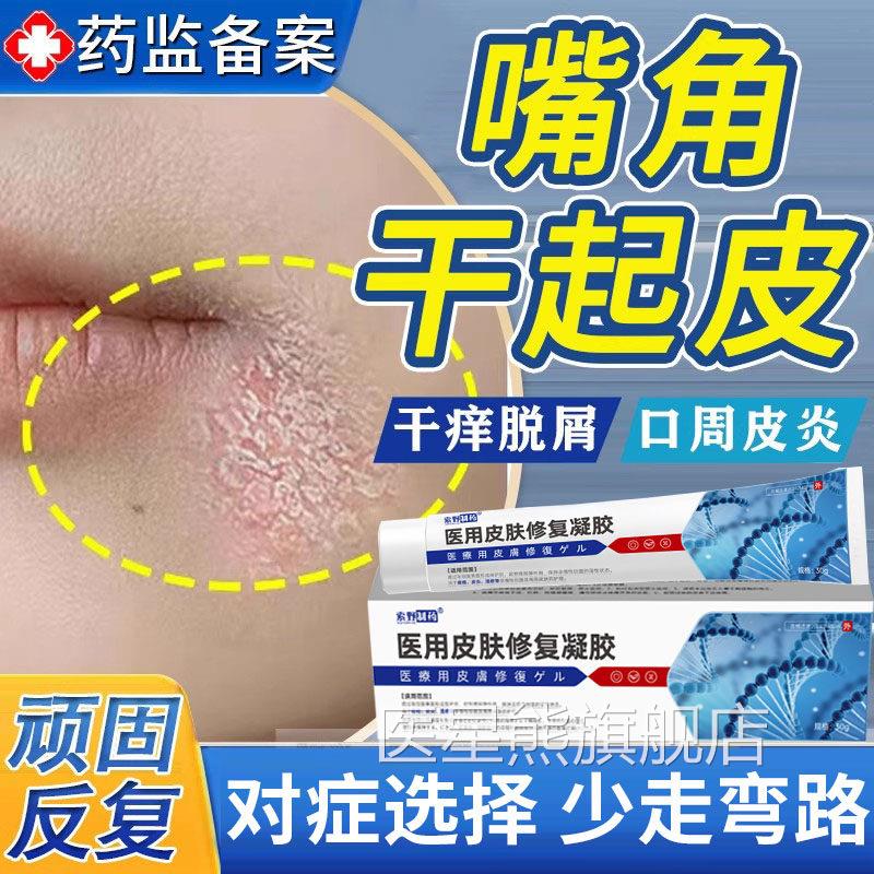 脸上嘴角干燥起皮口周皮炎药膏癣干脱皮有碎屑皮红痒儿童修复膏QQ