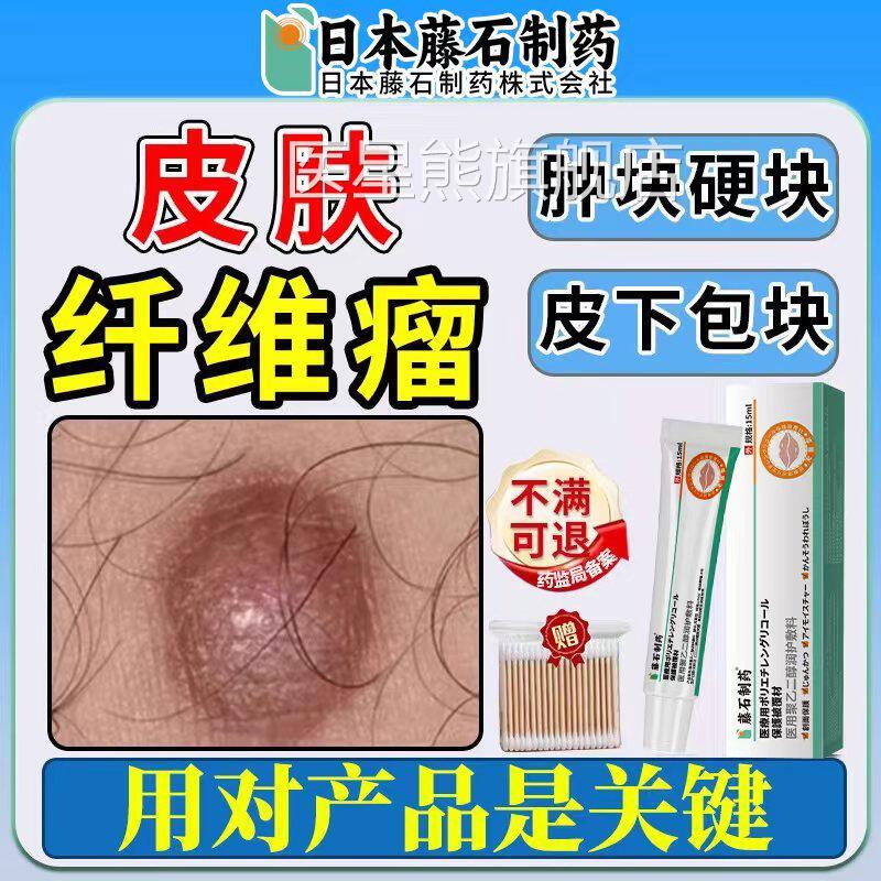 皮肤纤维瘤肿硬块去神皮下除器粉瘤监疙瘩可搭消瘤贴膏药备案HB医