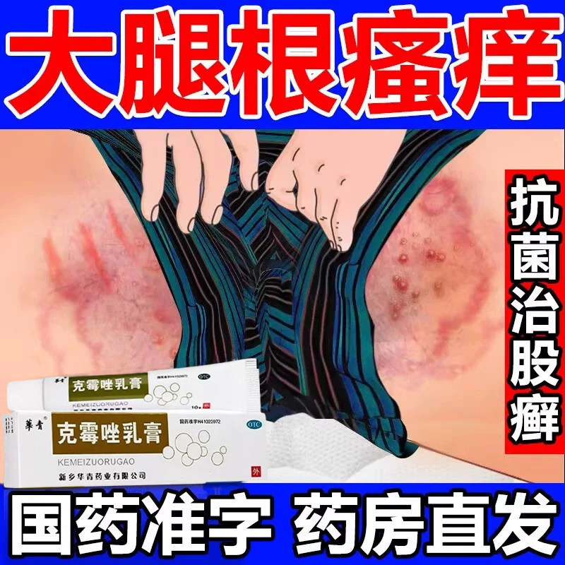 股藓专用药膏大腿内侧皮肤瘙痒外癣症
