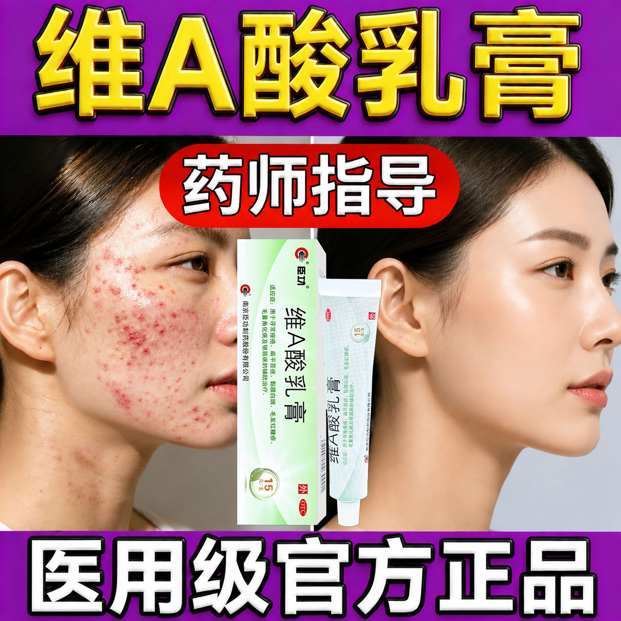 [臣功]维A酸乳膏0.025%*15g*1支/盒