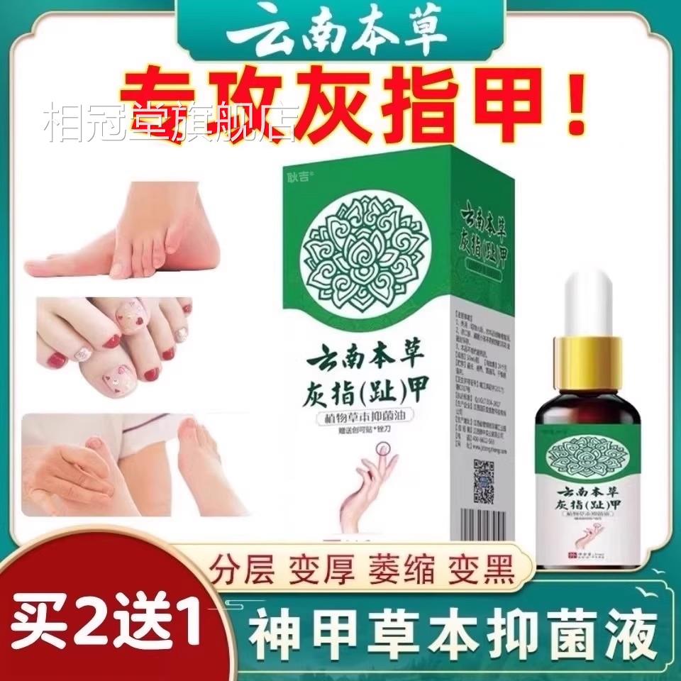 灰指甲液专用来脱甲药膏亮1锉药膏脚甲趾套冰醋酸正品变黄旗舰店