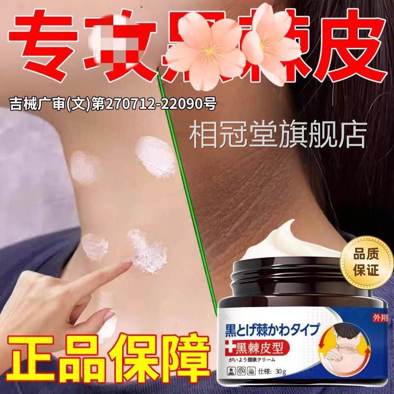 去脖子沉黑棘皮膏药黑色素淀去除颈部脖子黑肥胖洗不干净白神器30