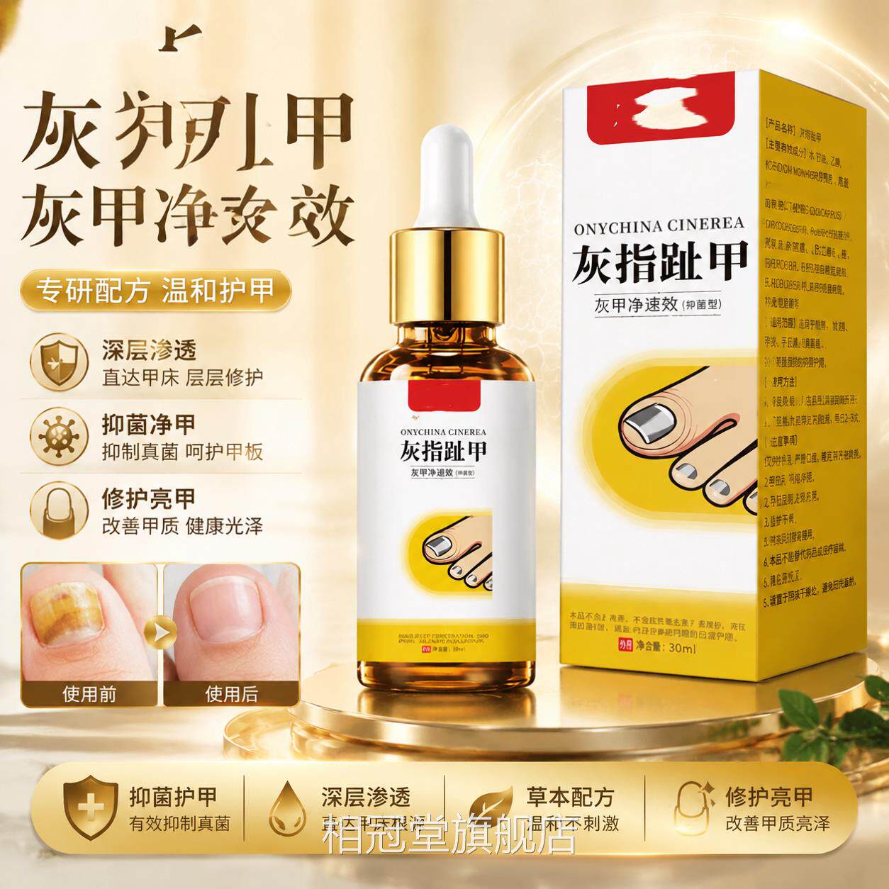 甲御医赫本灰指甲抑菌液30ml指护理液手部脚部指甲护理液亮甲液相