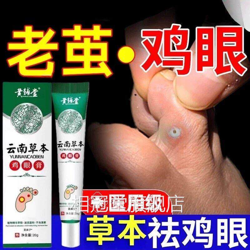 鸡眼贴除根专用用祛治疗脚鸡眼膏特官方医级正品膏水水杨酸相冠堂