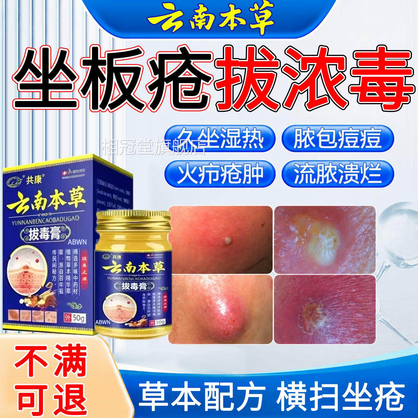 屁股上长痘膏痘痒起热疙瘩久坐板疮久坐湿热疖肿特止痒拔毒效药疼