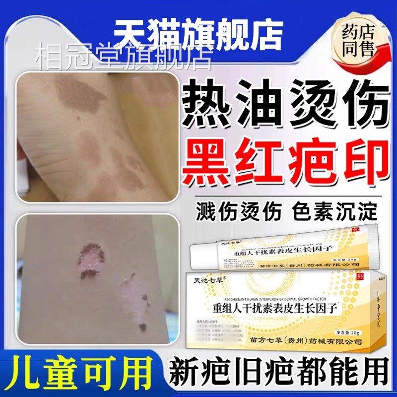 热油油烫伤烧伤去疤膏疤痕修复膏除疤儿童祛去红印黑印色素沉淀20