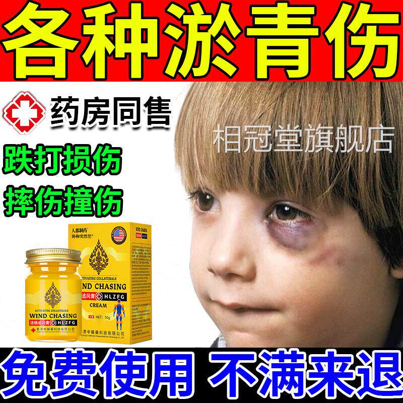 淤青膏快速消除宝宝淤青眼部眼睛活血化膏瘀去淤青摔倒膝盖腿磕碰