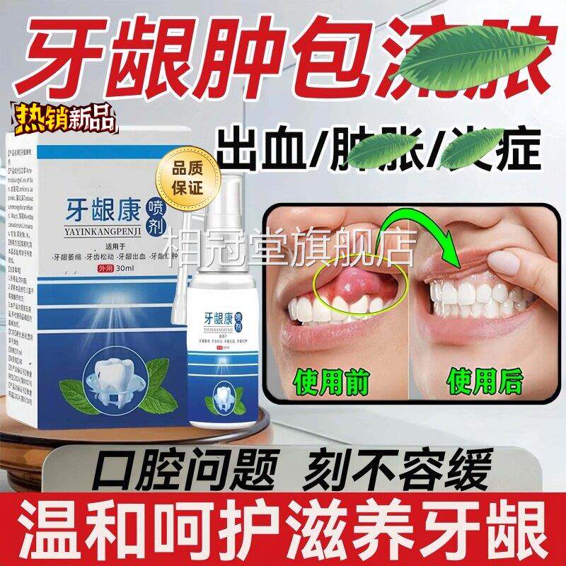正品牙龈康喷肿剂官方旗舰店牙齿口腔抑菌止痛消痛炎牙龈萎缩喷雾