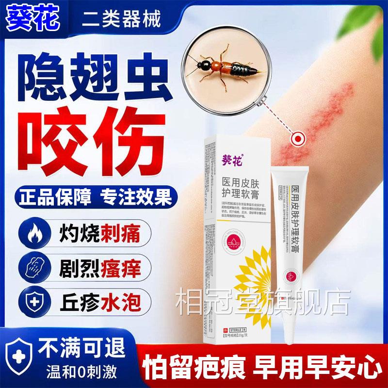 葵花隐翅虫红蚂蚁叮咬伤预防留疤痕过敏膏痒肿灼烧感特专用效L相