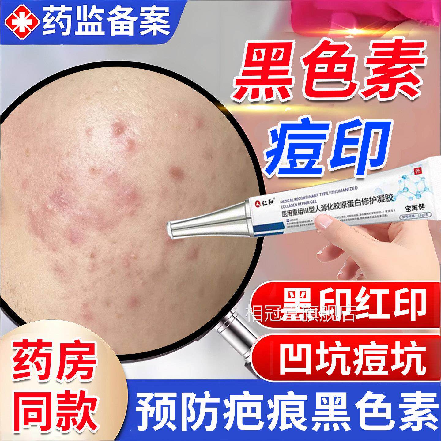 痘黑色素沉淀去除黑印红印痘坑修复男医用型淡化印痤疮疤痕青少年