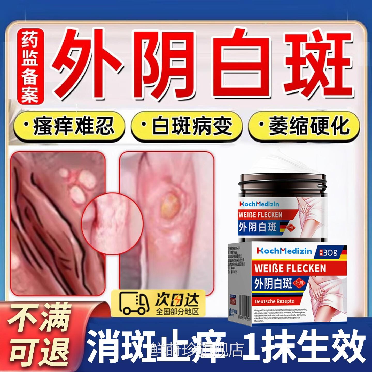 外阴白斑专用膏止痒去萎道缩瘙痒根营养不良白斑净白斑克星阴炎鲜