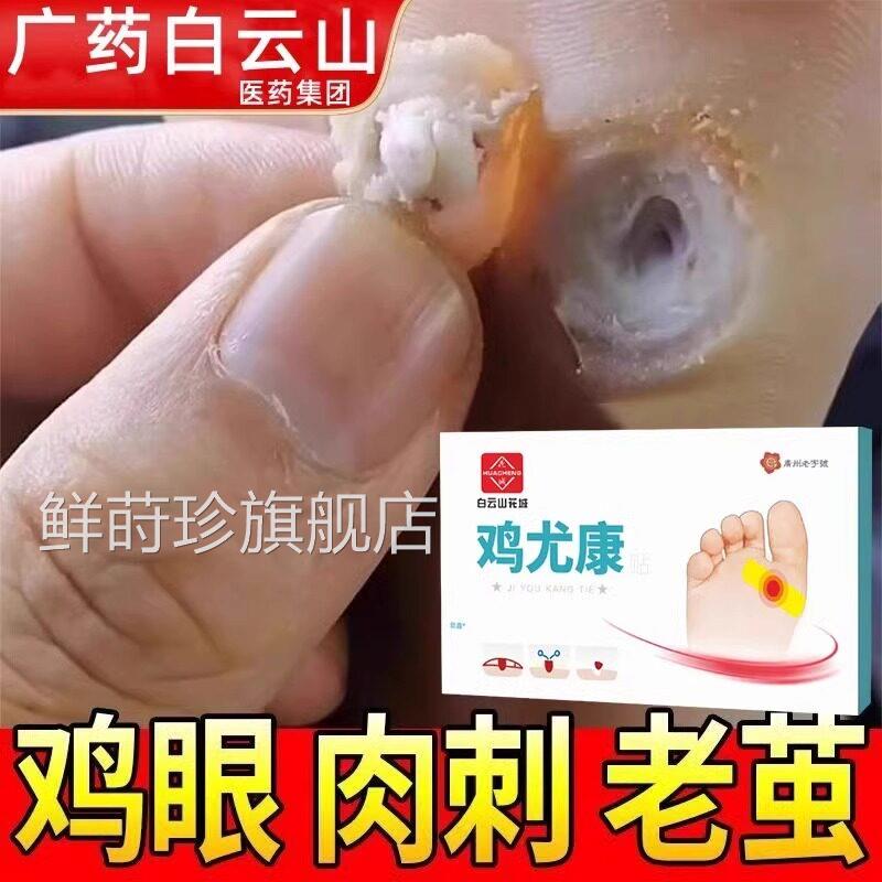 白云山鸡药膏贴瘊子手足部护理去脚底眼脚趾跖疣灵老茧根肉刺死皮