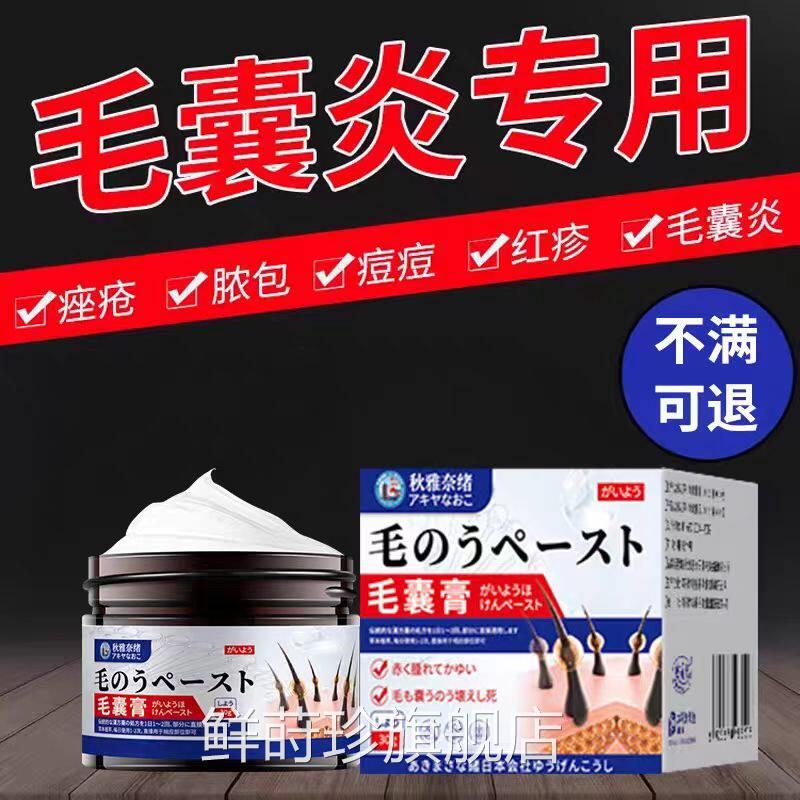 马拉菌前胸后背治头皮色毛囊炎专用头部脖子私处痘痘中药酊疗膏药