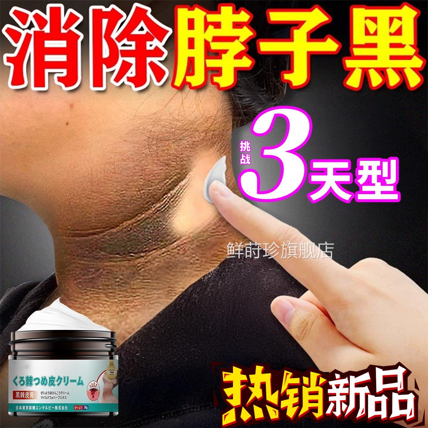 脖子黑色色素去除黑棘皮膏素沉淀儿童脖子腋下洗不干净美白神器30