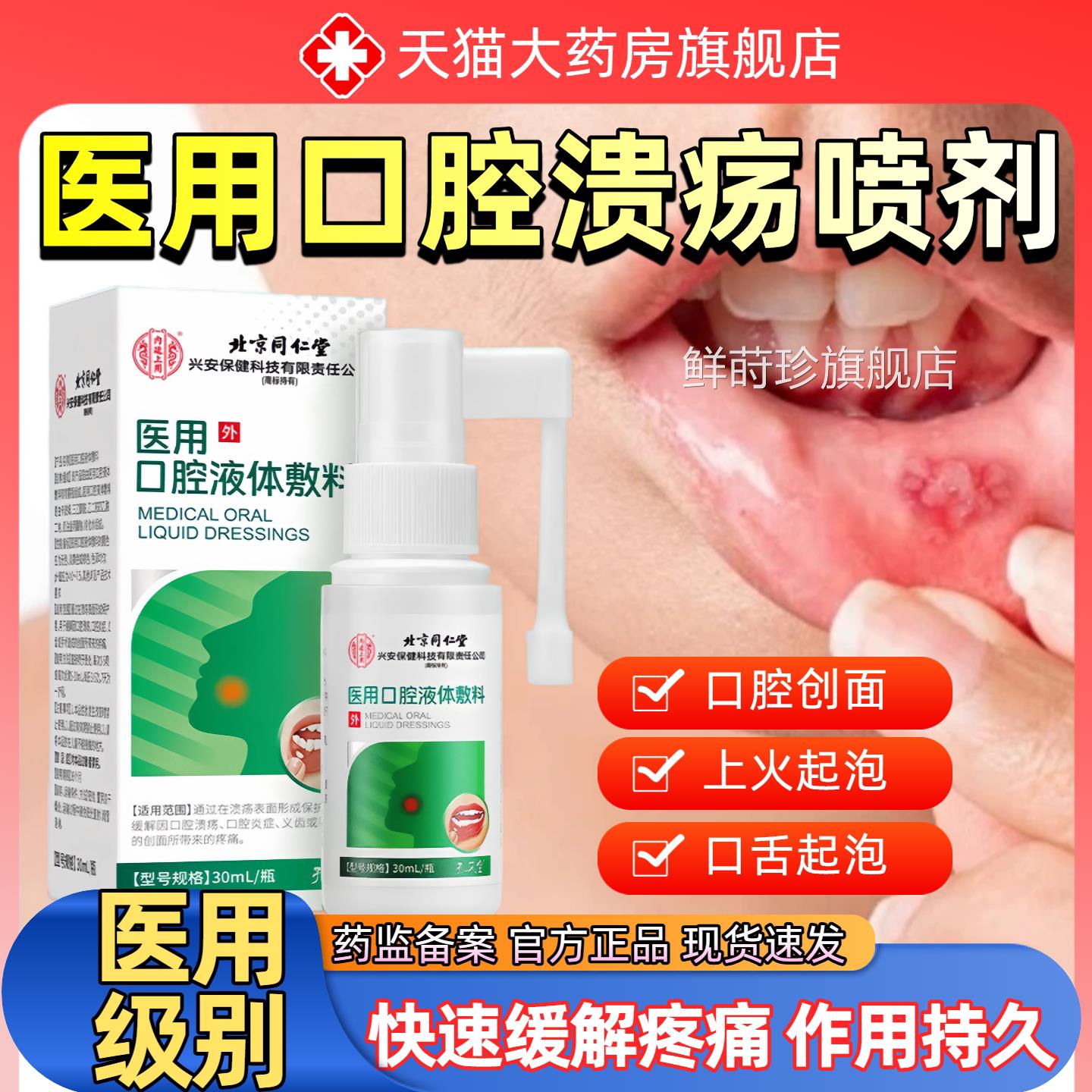 口腔溃抑疡喷剂舌头嘴上火喷雾口舌生菌清新喷雾剂医用级官方正品