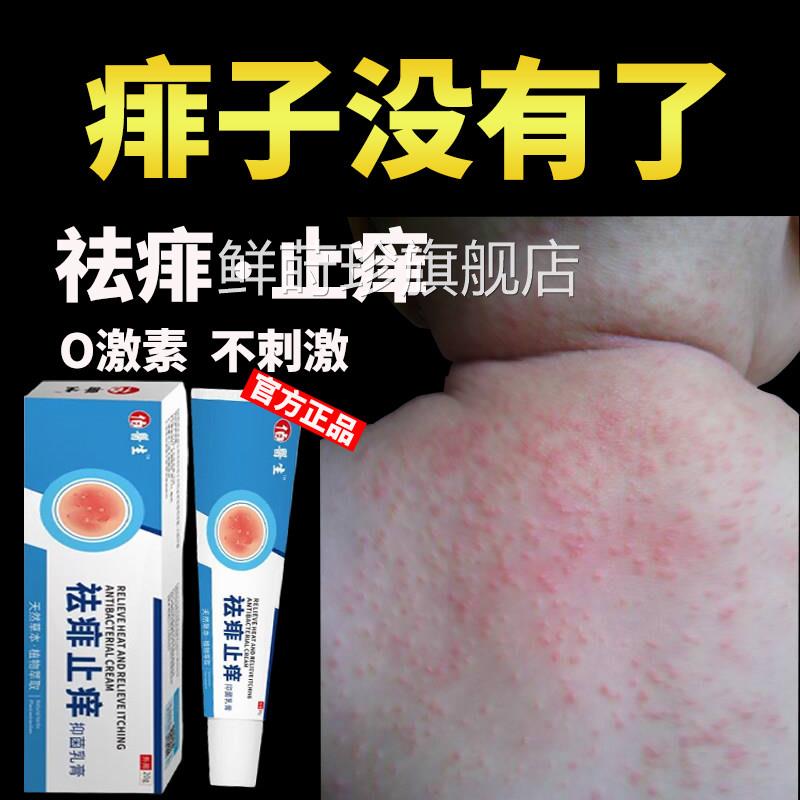 痱子膏去止痱痒治宝宝儿童婴小孩身上起红痱长热痱药祛痱神器儿水