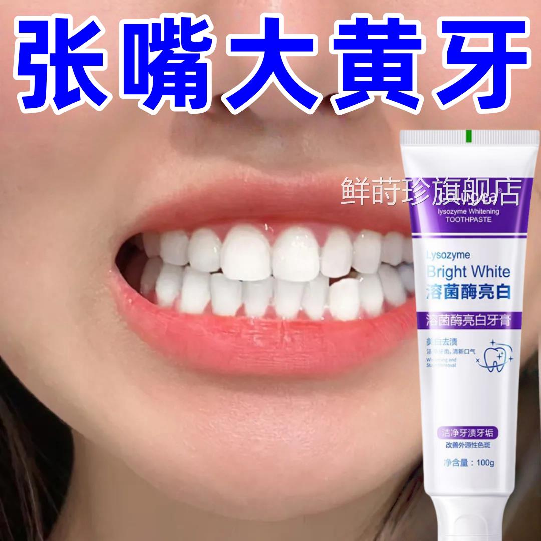 【快速亮白牙】亮渍白去渍牙去黄牙黑牙去烟口臭牙齿炫白脱色剂鲜