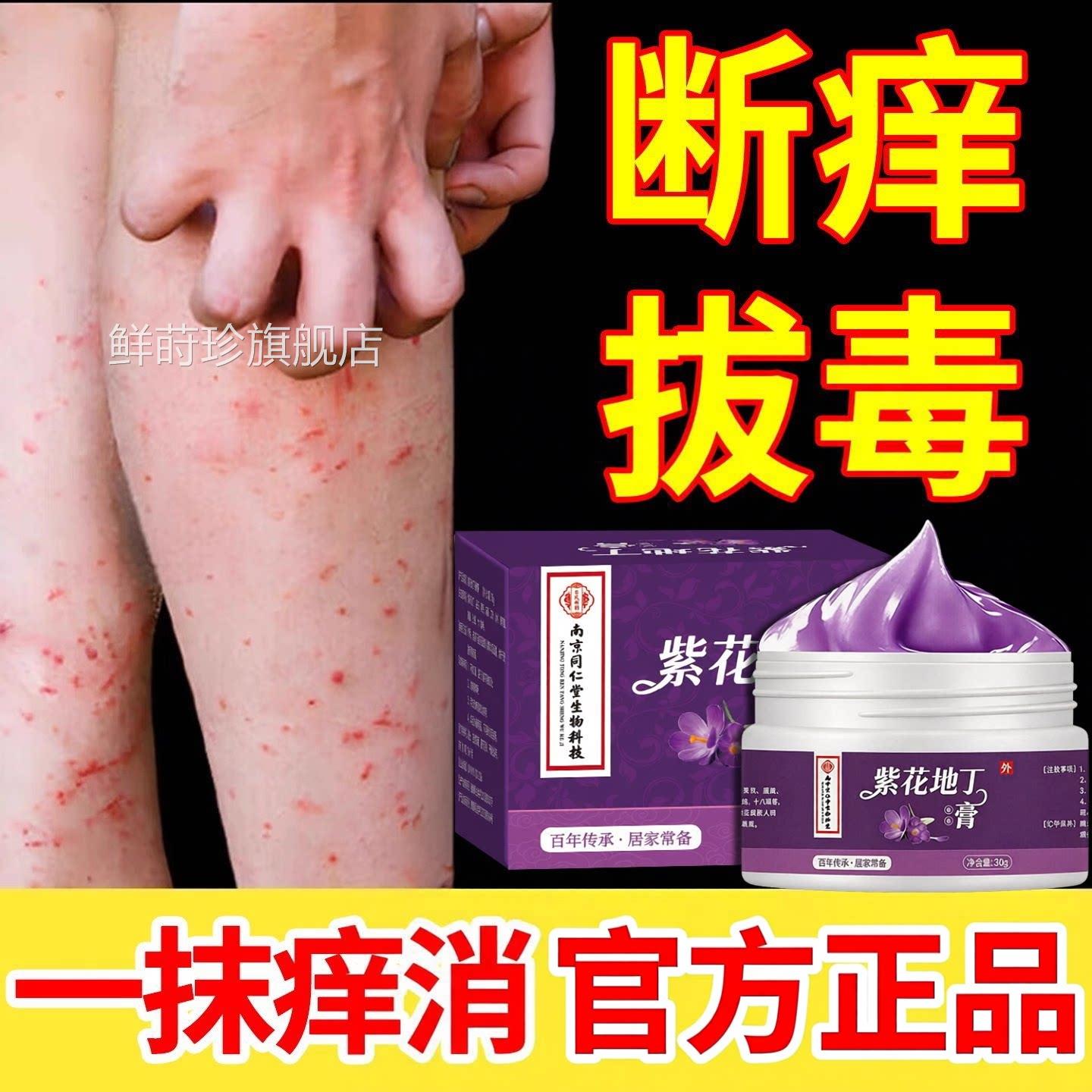 紫花地丁断痒王皮肤止痒全身真菌感染皮肤瘙外用紫花地痒丁抑菌膏