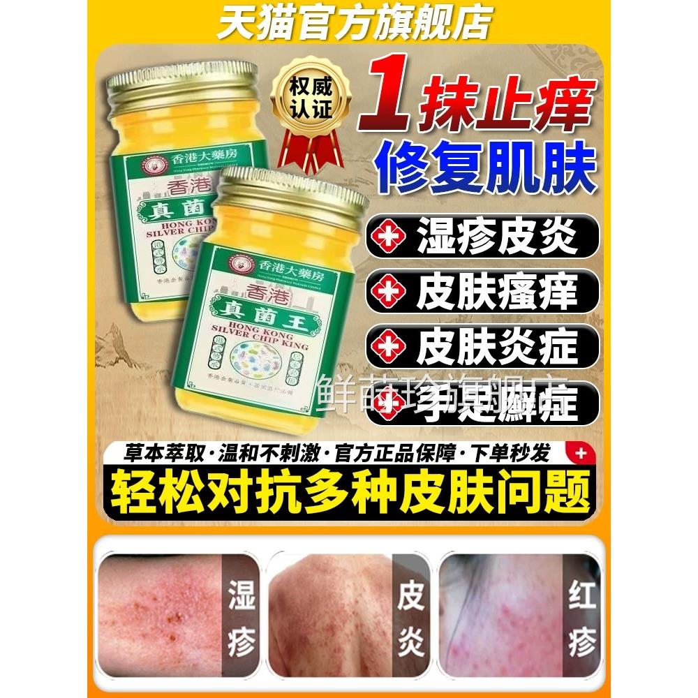 云南真菌王官方旗舰店正品止1膏皮肤瘙1痒1药膏皮1炎牛皮1痒癣鲜