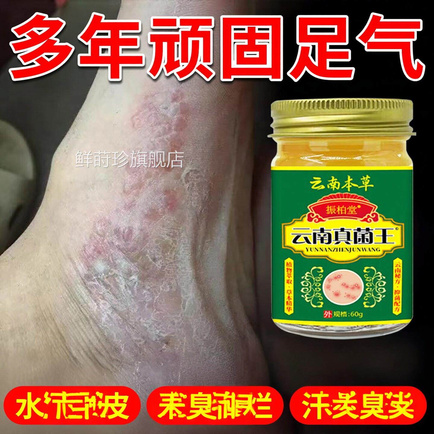 云南真菌王足气皮足痒足臭足缝痒烂足膏防止脱水泡足脱皮足趾臭膏