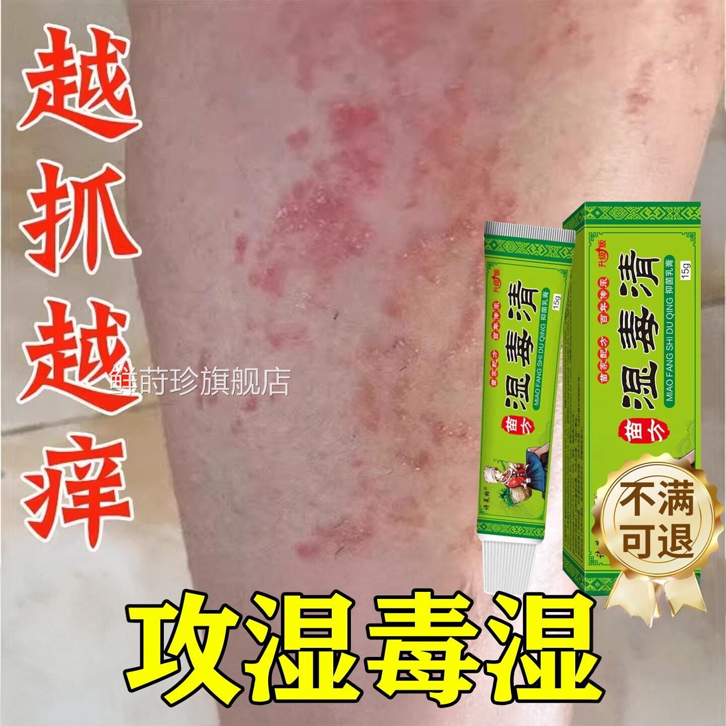 湿毒清软膏祛湿热止湿痒痒根皮肤皮瘙炎痒水泡治除湿用膏鲜莳珍旗