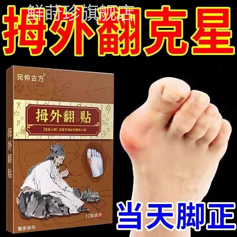 星拇指外翻药膏贴拇囊炎疼痛大脚骨脚趾畸形肿胀矫正神器女克神器