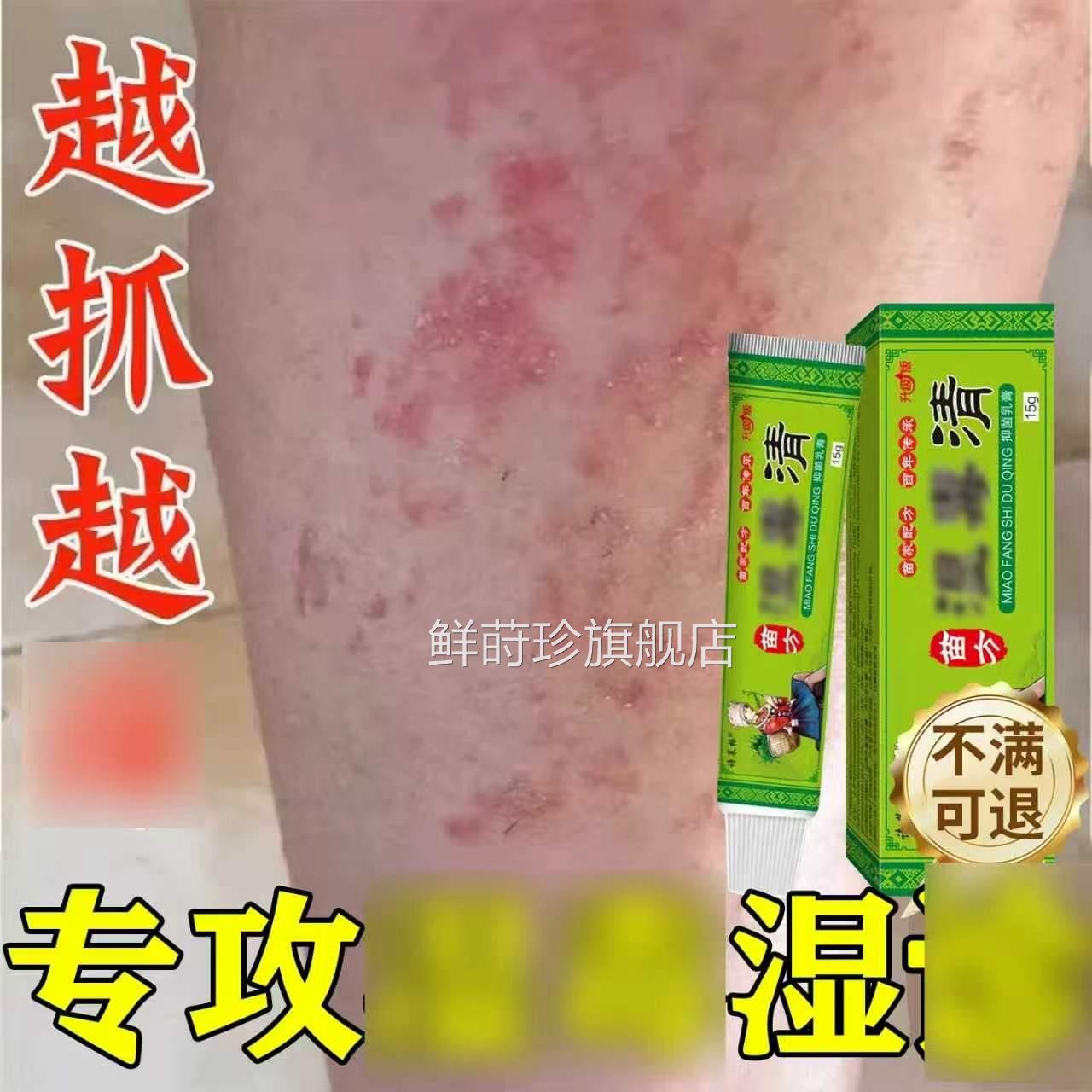 皮肤止痒膏湿毒清私处阴囊软膏去瘙痒专用男女外旗用舰店正品官方