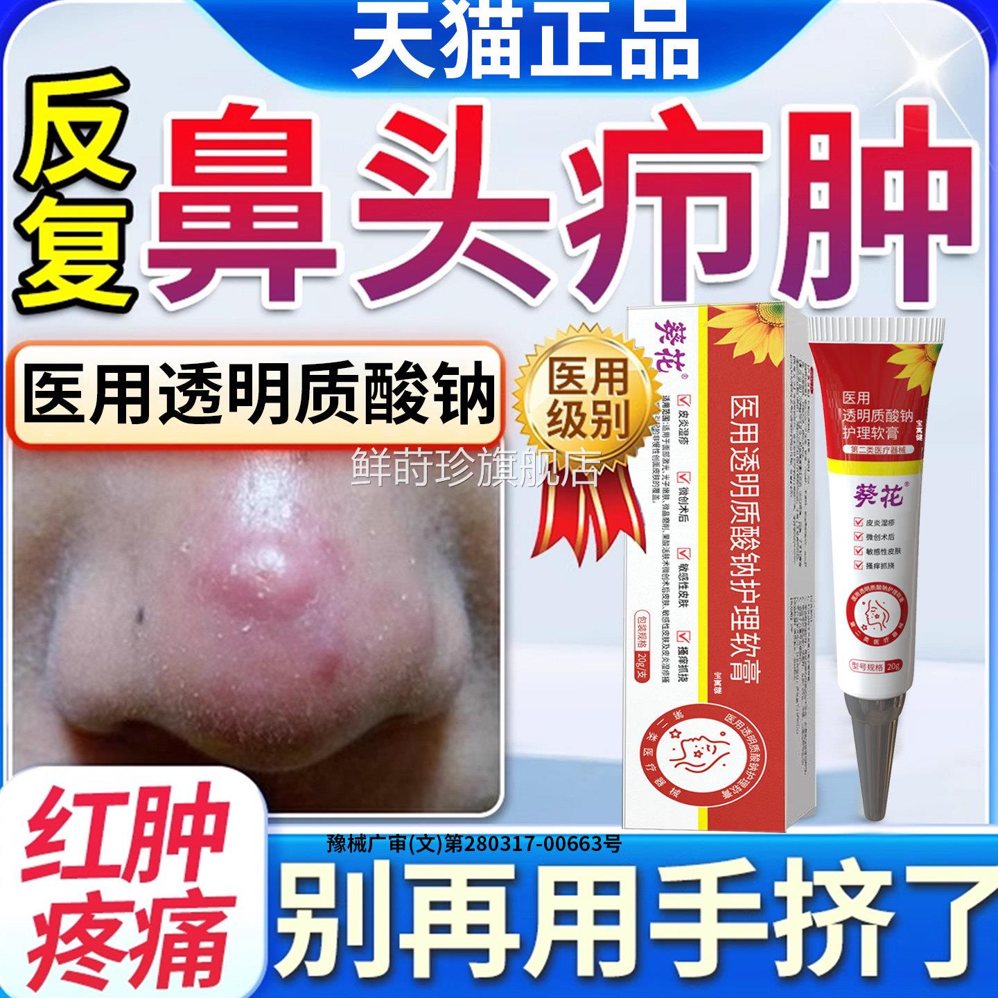 鼻子头上长痘痘鼻头鼻尖红肿火疖子毛炎肉疙囊瘩长脓包型去的药膏