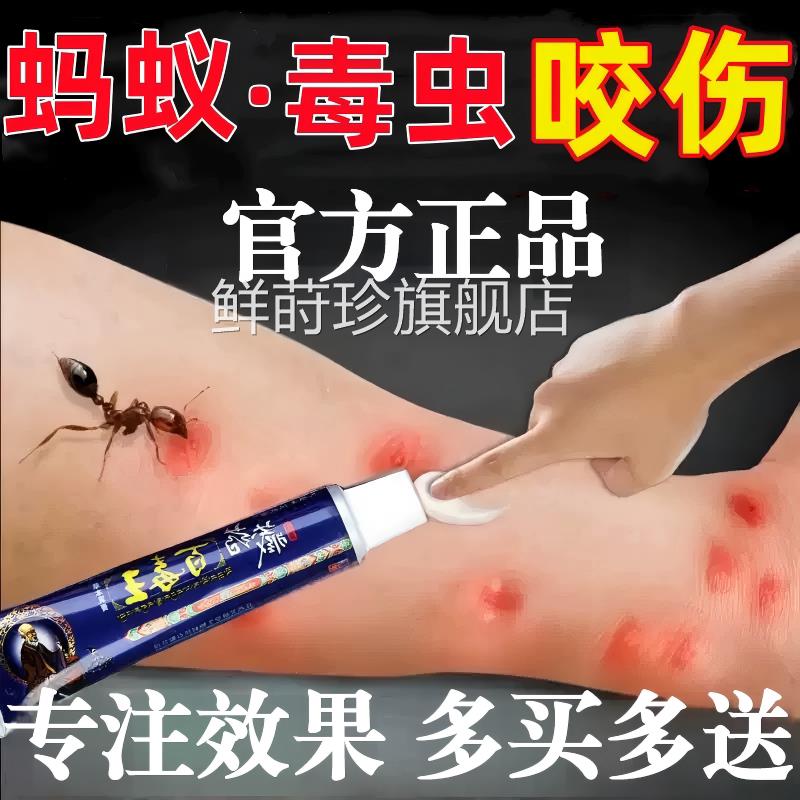 蚂蚁毒虫咬膏蚊虫叮咬隐翅虫伤跳蚤螨虫叮咬消肿外用抑止痒膏正品