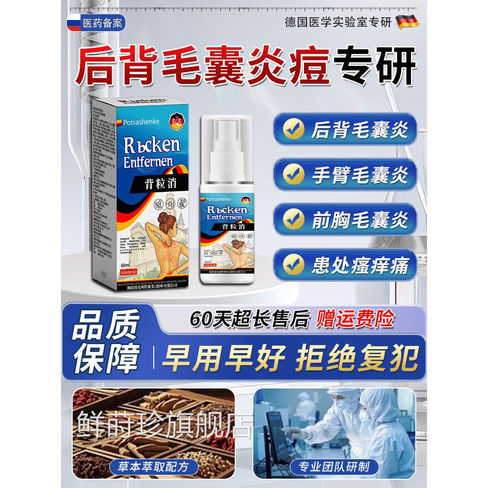 马拉色菌前后背背后长痘痘毛囊炎除螨祛痘痒手臂胳膊疙瘩喷雾胸剂